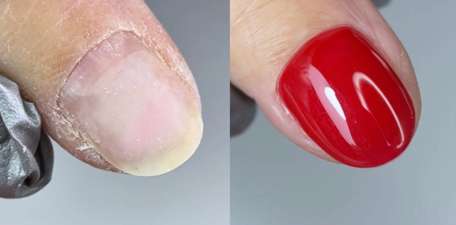 Working With a Mature Cuticle Lesson
